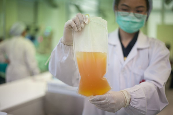 Nurse inspecting blood bag with platelets